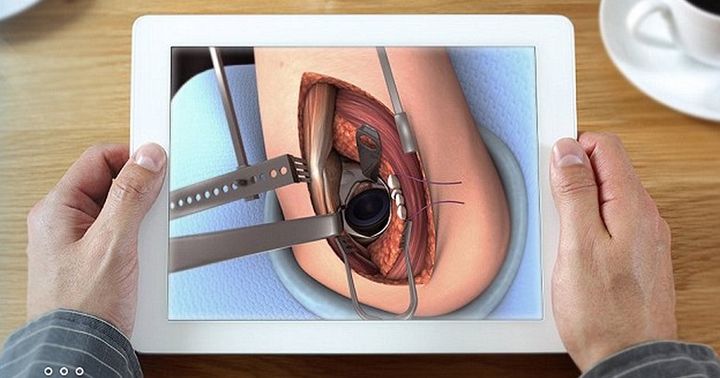 Touch surgery: how to cut the appendix on the tablet or smartphone